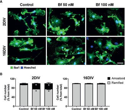 Microglia Susceptibility to Free Bilirubin Is Age-Dependent